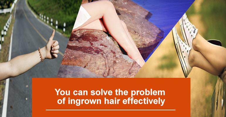 Causes Of Ingrown Hair Sugaring And Solutions To Problems