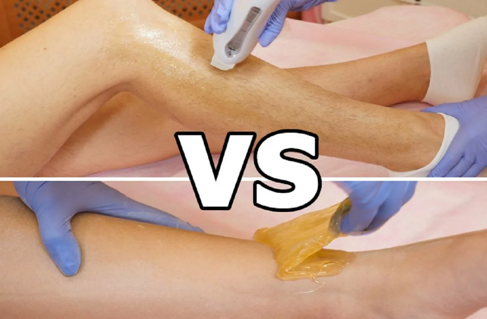 Sugaring and Laser Hair Removal Pros and Cons Sugaring Factory Blog